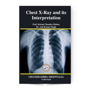 Chest X-Ray and Its Interpretation